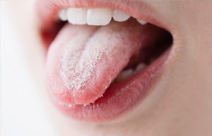 如何判斷自己是否濕氣重